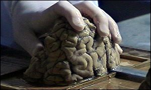 Brain