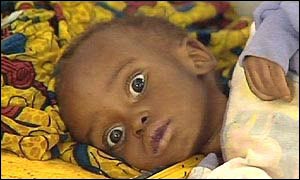 Baby in Malawi