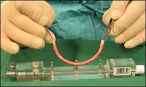 A blood vessel ready for surgery