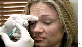 Botox injections