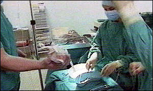 There is a shortage of organs for black patients