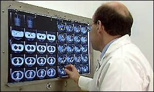 Bowel scan