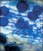 Mycorrhizae in plant roots   Science