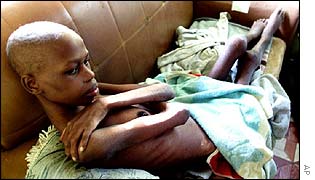 A South African Aids victim