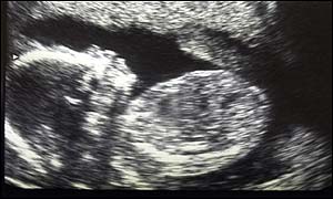 Baby scan