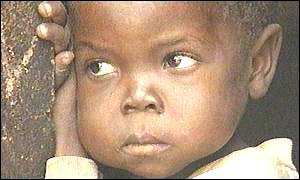 Malnourished girl 