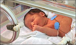 Baby in incubator
