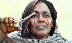 Female circumcision