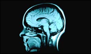 Brainscan
