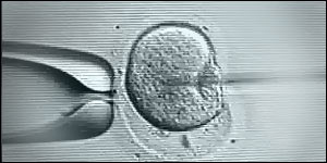 ICSI process - injecting the egg with a sperm