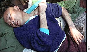 Chinese Aids victim
