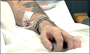 Arm and drip