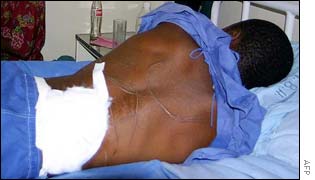 Victim of political violence