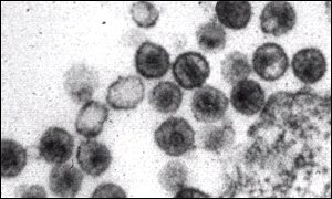 HIV cells attack the immune system