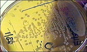 Petri dish