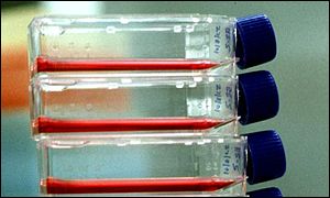 Lab analysis