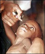 Young child is administered with the polio vaccine
