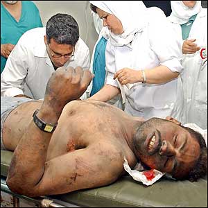 Palestinian doctors treat a man, wounded by shrapnel  (Photo: AP)