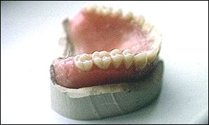 Dentures