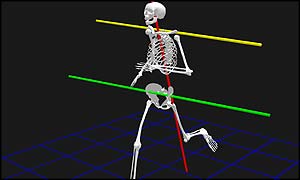 Skeletal image