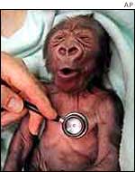 Gorilla and stethoscope   AP