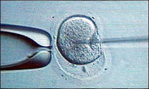 ICSI procedure
