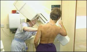 Screening does not always find fast-growing tumours, scientists said.