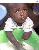 Child amputee