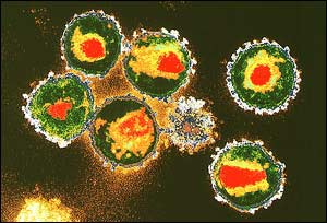 HIV, SPL