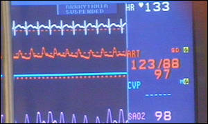 Heart monitor