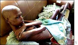 Aids patient in Africa   