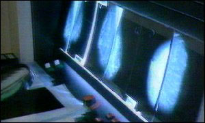 Radiography screens