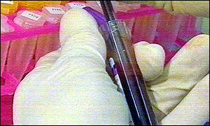 Blood test