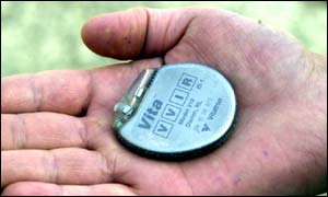 Pacemaker
