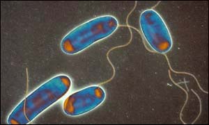 Legionnaires' disease
