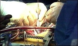 An operation