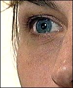 Eye