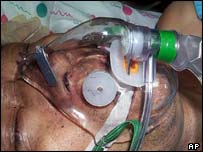 Kim Dae-hwan, 56, at a hospital in Daegu city
