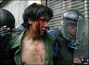 Injured protester in police custody