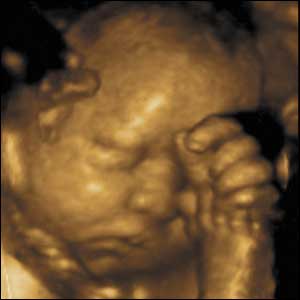 28 weeks gestation. 28cm from crown to rump.