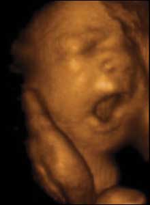 29 weeks gestation. 28cm from crown to rump.