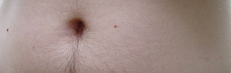 A gut