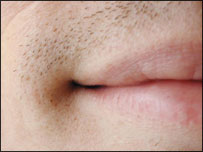 mouth