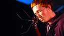 Arcs and Trauma - Cashmere Lungs - BBC Introducing