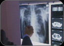 An X-ray of Shelia's lungs