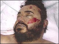 الزرقاوی