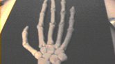 Skeletal hand... Skeletal hand...