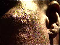 Skin damage