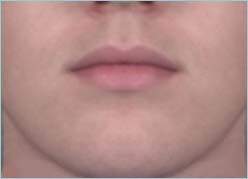 A male jawline