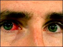 Olhos